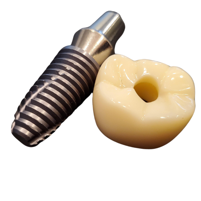 Cirugía de implantes dentales