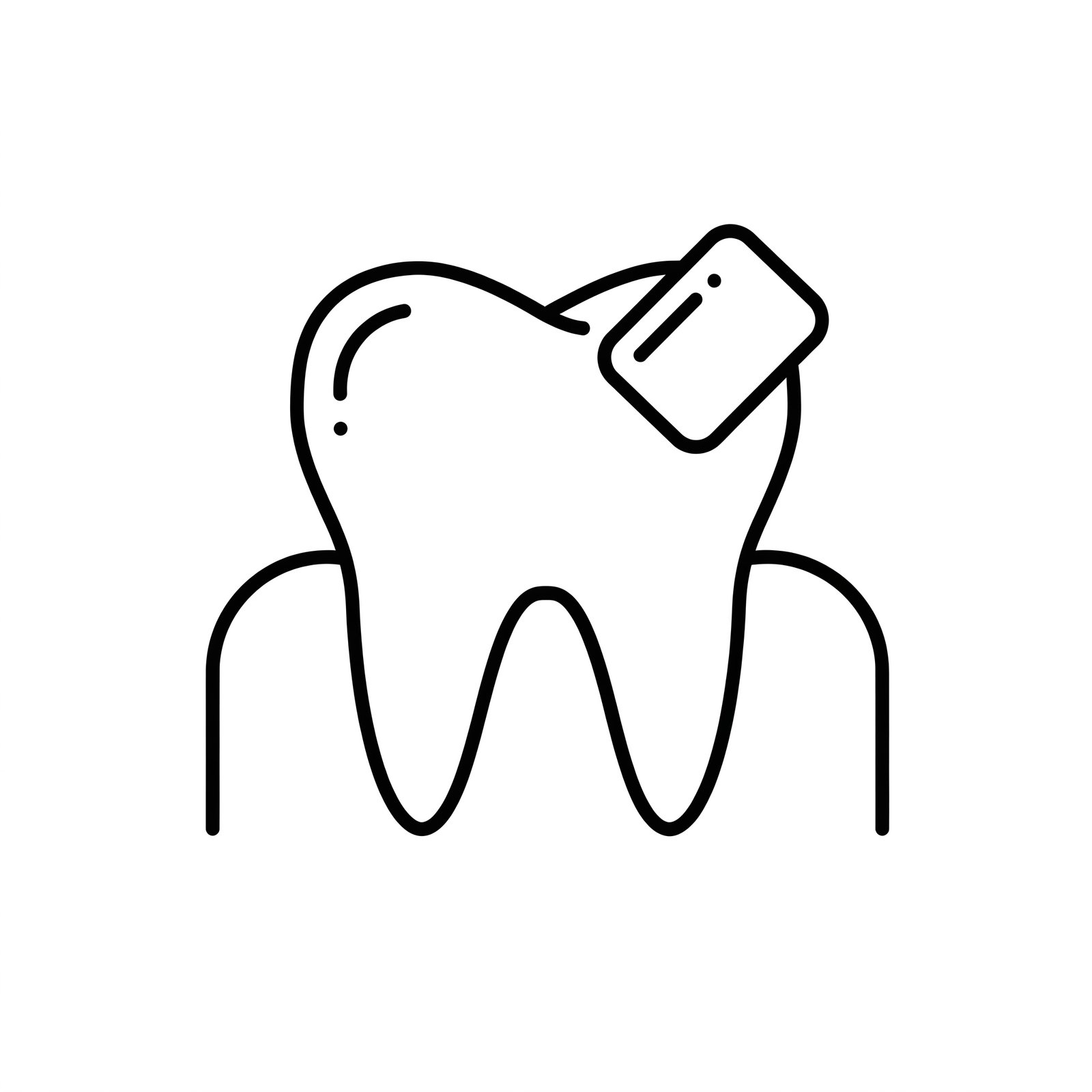 Carillas Dentales